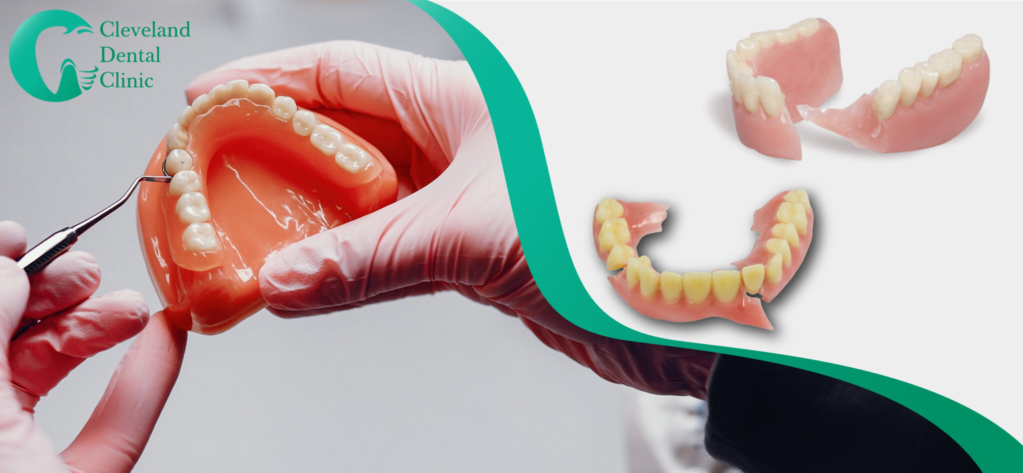 How to repair broken dentures? Blog