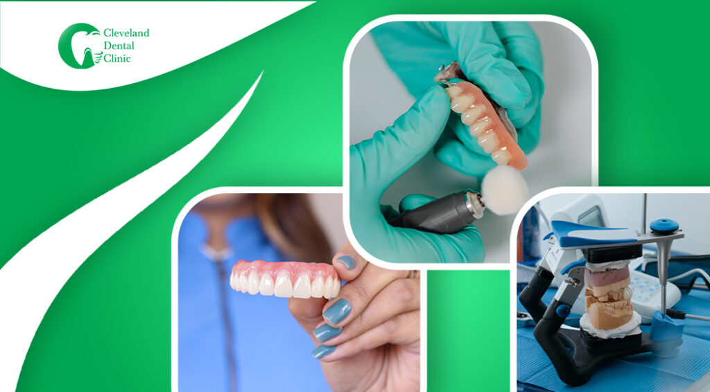 4 signs you need a denture reline.