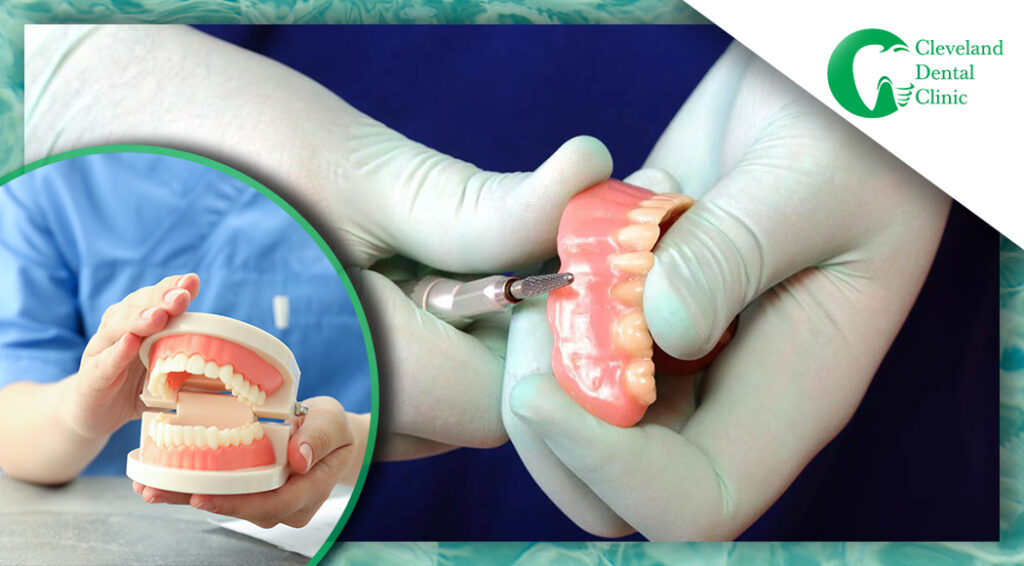 Denture relines Why do you need them? Blog Hard Reline