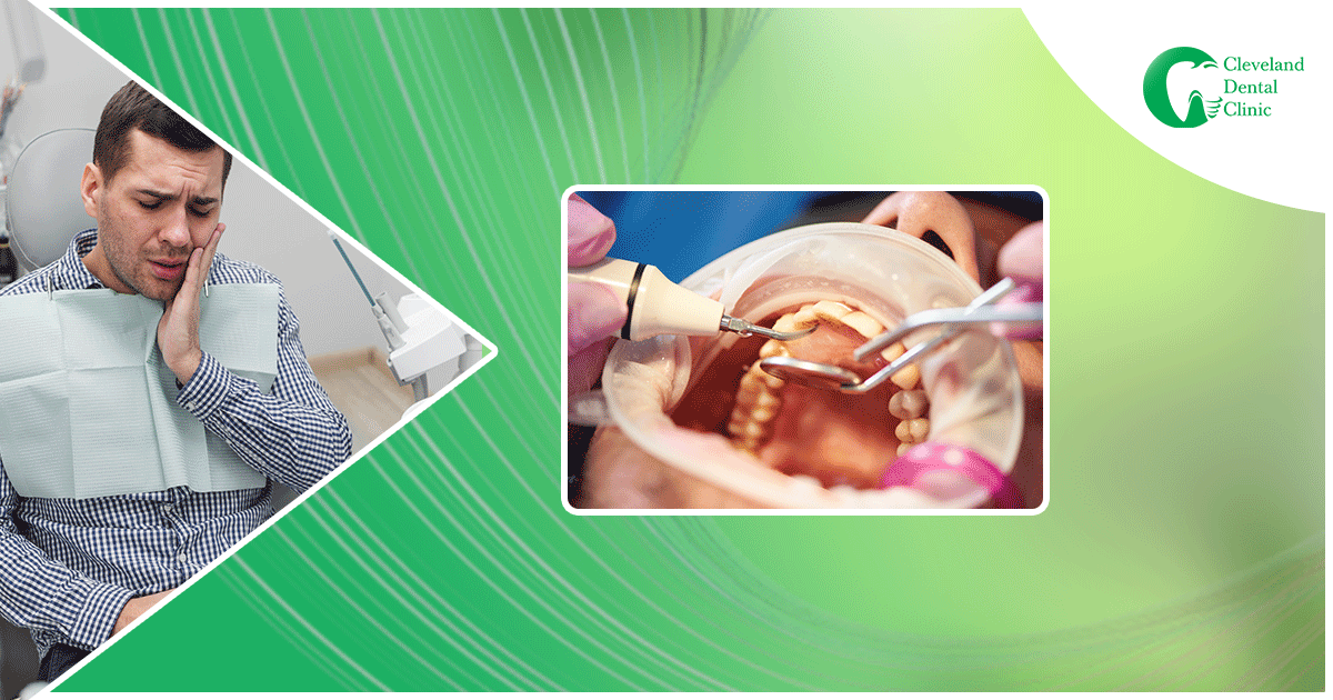 dental-hygienist-performing-teeth-cleaning-procedure-and-specialized-tools-to-remove-plaque-and-tartat-buildup